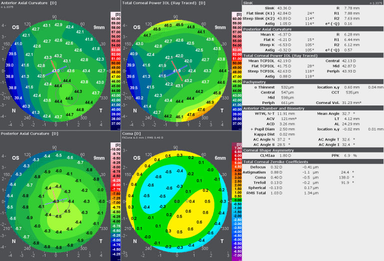 advanced_iol_display