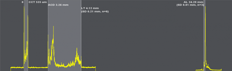 biometry_scan