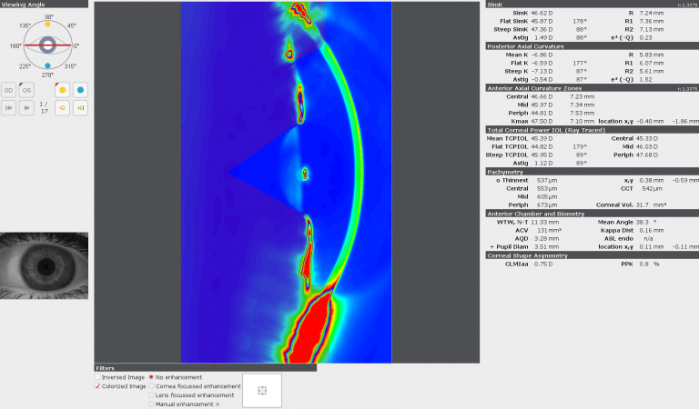 eye_metrics_display