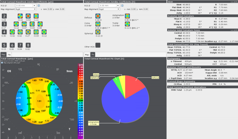 wavefront_display